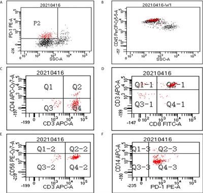 A Novel Mechanism of Action of Histone Deacetylase Inhibitor Chidamide: Enhancing the Chemotaxis Function of Circulating PD-1(+) Cells From Patients With PTCL